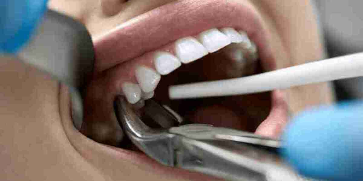 Can You Smoke After Getting a Tooth Pulled?