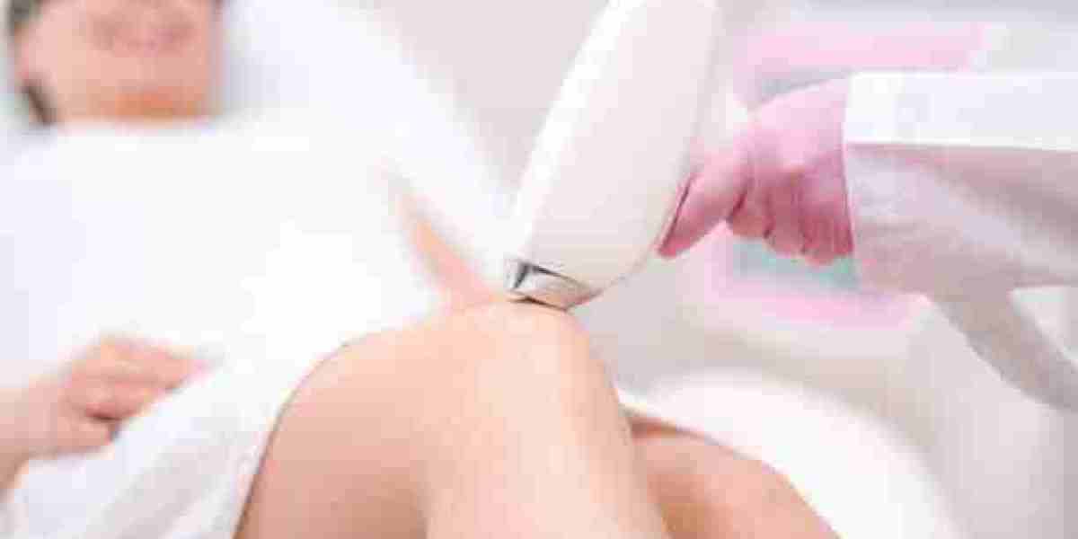 Affordable Laser Hair Removal in Riyadh