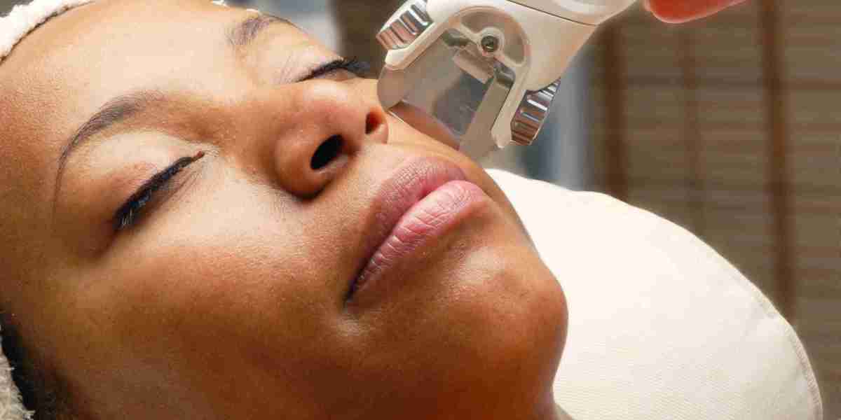 Will Facial Laser Treatments Work for Rosacea or Redness?