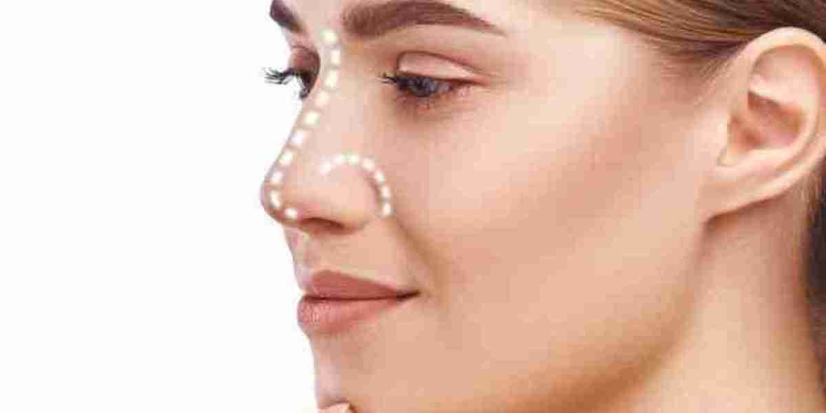 Celebrity Rhinoplasty Trends in Riyadh