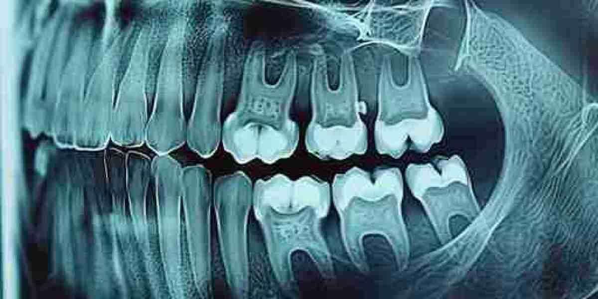 Is It Safe to Get Multiple Panoramic X-Rays?