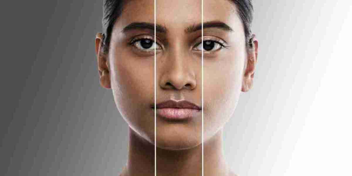 Laser Skin Whitening: Pros and Cons