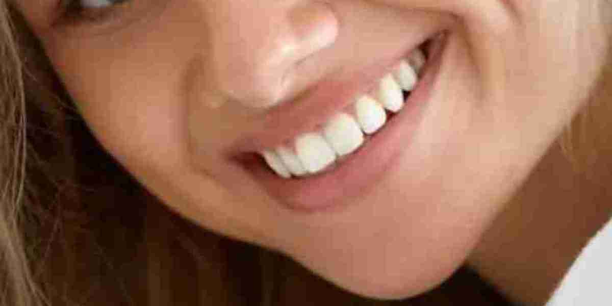 Leading Dimple Creation Centers in Riyadh: Crafting Your Perfect Smile