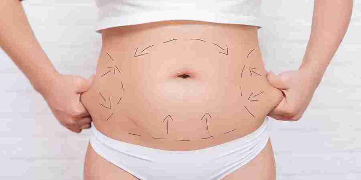 Can a Full Tummy Tuck Restore Muscle Tone in Islamabad?
