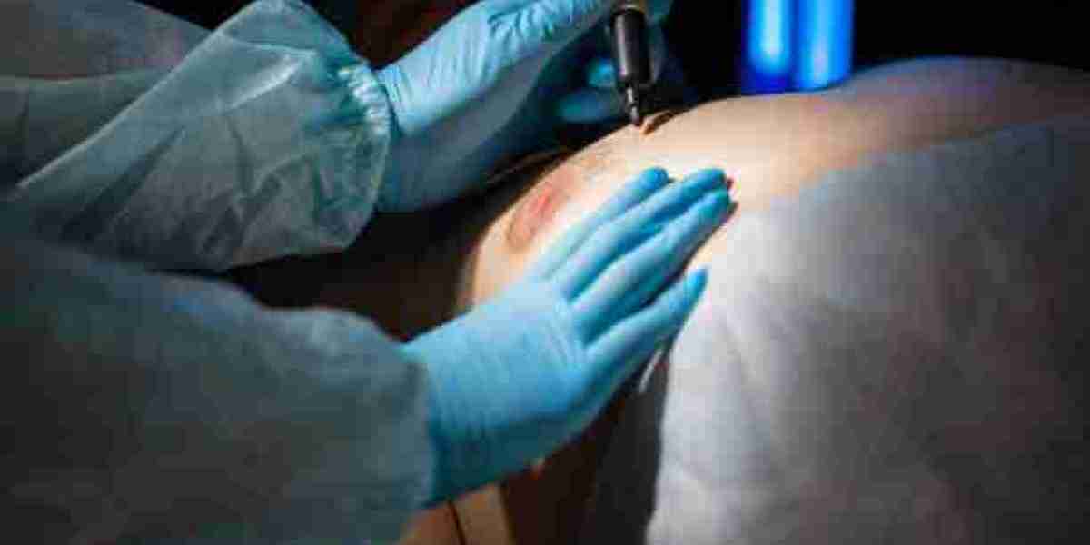 Smooth Chest Transformation – Gynecomastia Surgery in Riyadh