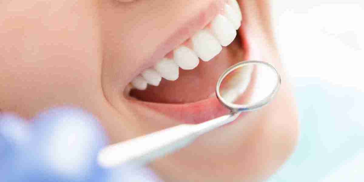 Luxury Teeth Polishing Riyadh Specialists