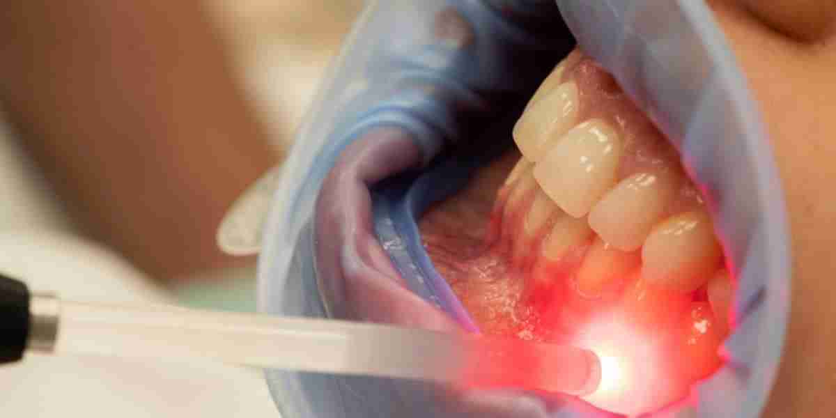 What should I look for in a gum depigmentation clinic?