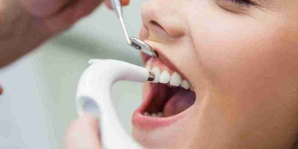 Laser Teeth Cleaning Options in Riyadh