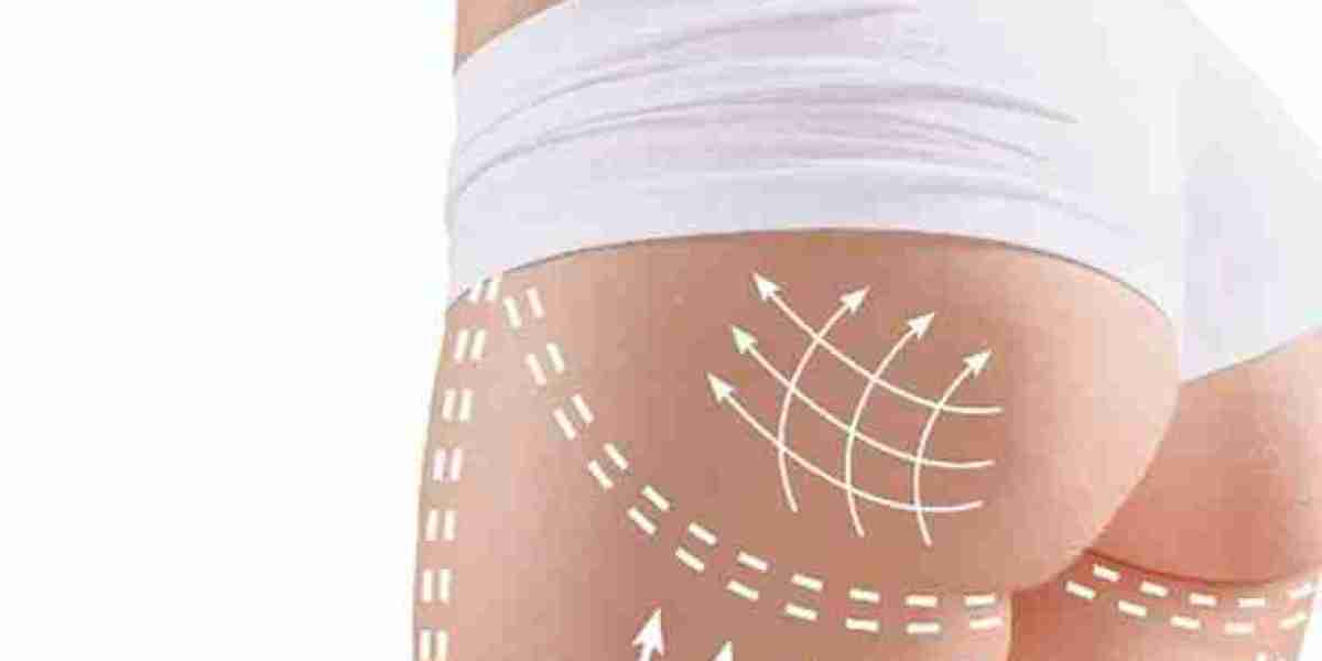 Thigh Lift for Cellulite Riyadh Reduction?