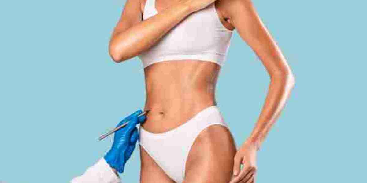 Ideal Candidates for Tummy Tuck in Riyadh