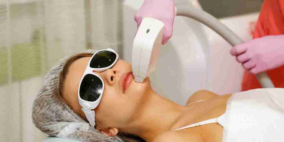 Will Laser Hair Removal Affect My Skin Tone or Cause Discoloration?
