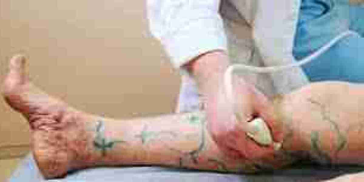 Government vs Private Hospital Cost Comparison for Varicose Veins in Pune