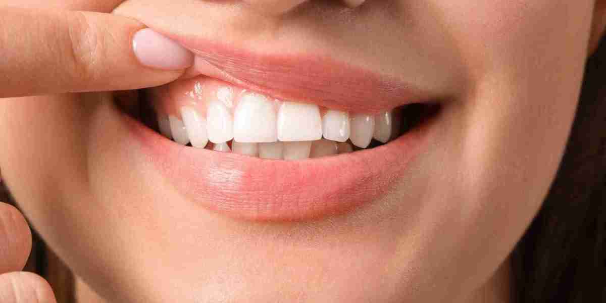 What Are the Risks of Gum Contouring?